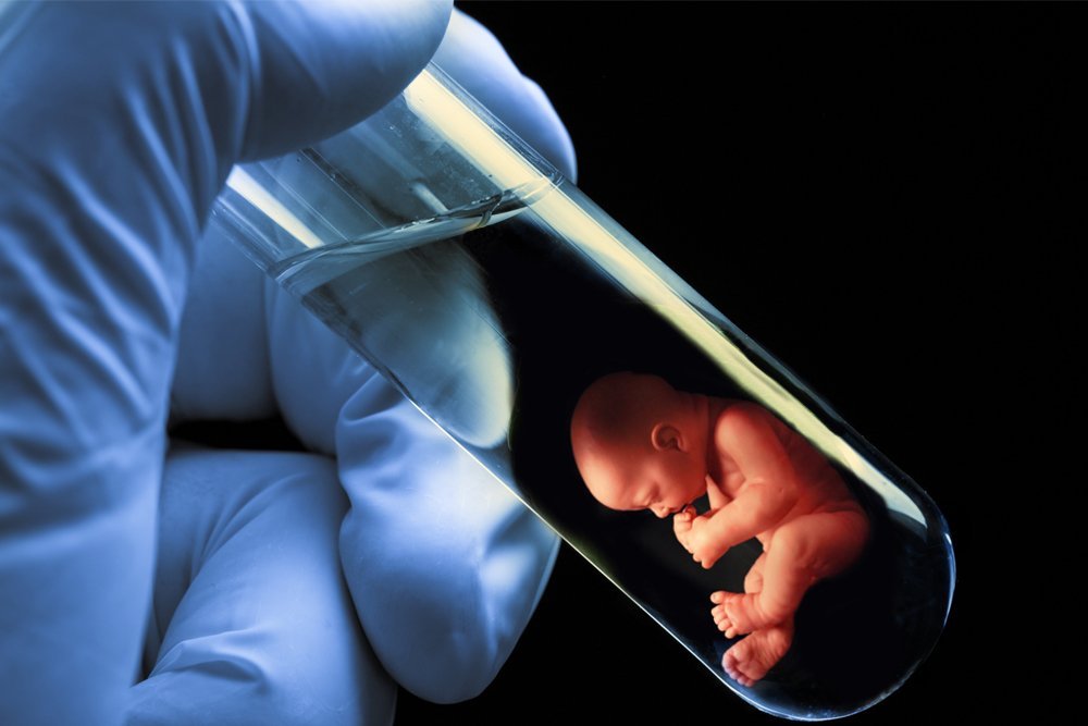 in vitro fertilization babies