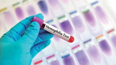 Understanding Hemophilia