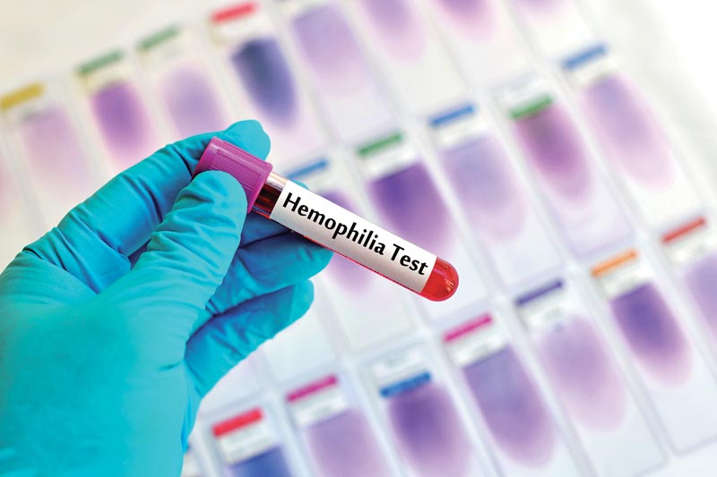 Understanding Hemophilia